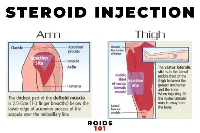 steroid injection arm thigh